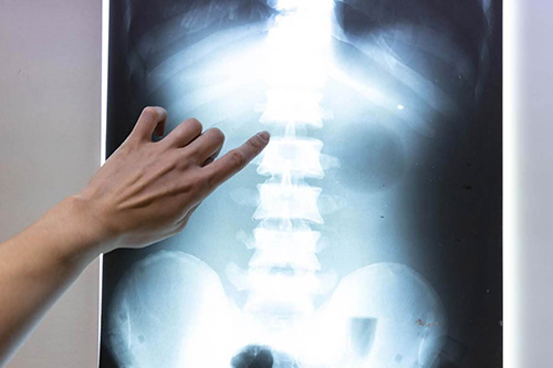 A health care professional refers to an x-ray of a patient