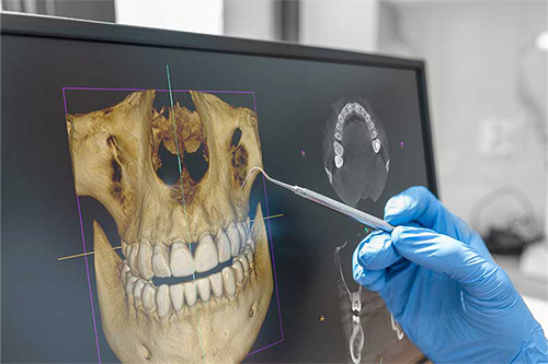 Basics of Dental CBCT (Cone-Beam Computed Tomography)